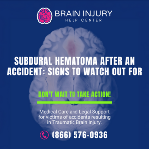 subdural hematoma
