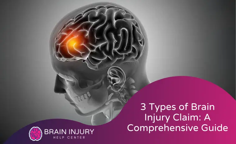 brain injury claim