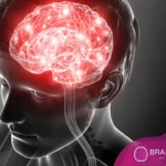 lesiones cerebrales traumáticas