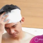 Víctimas de accidentes por TBI